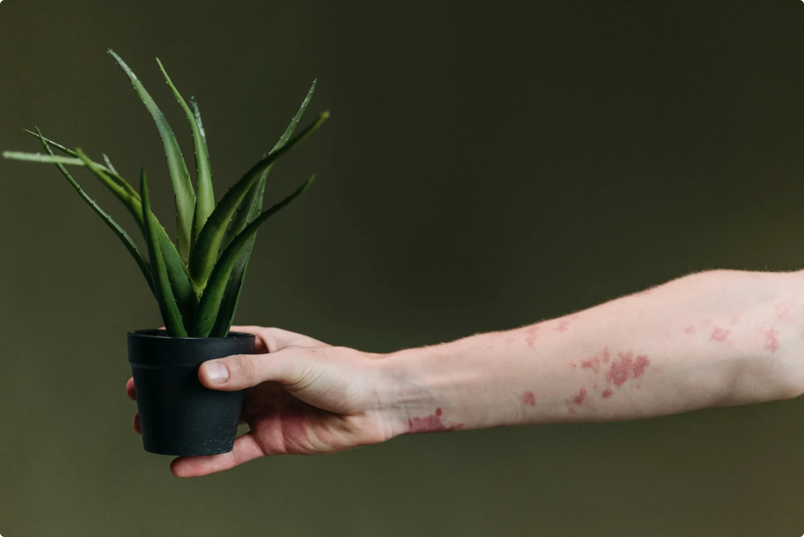 TCM Behandlung bei Ekzemen und Neurodermitis Zürich