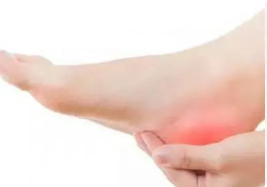 TCM Behandlung bei Fersenschmerzen Zürich