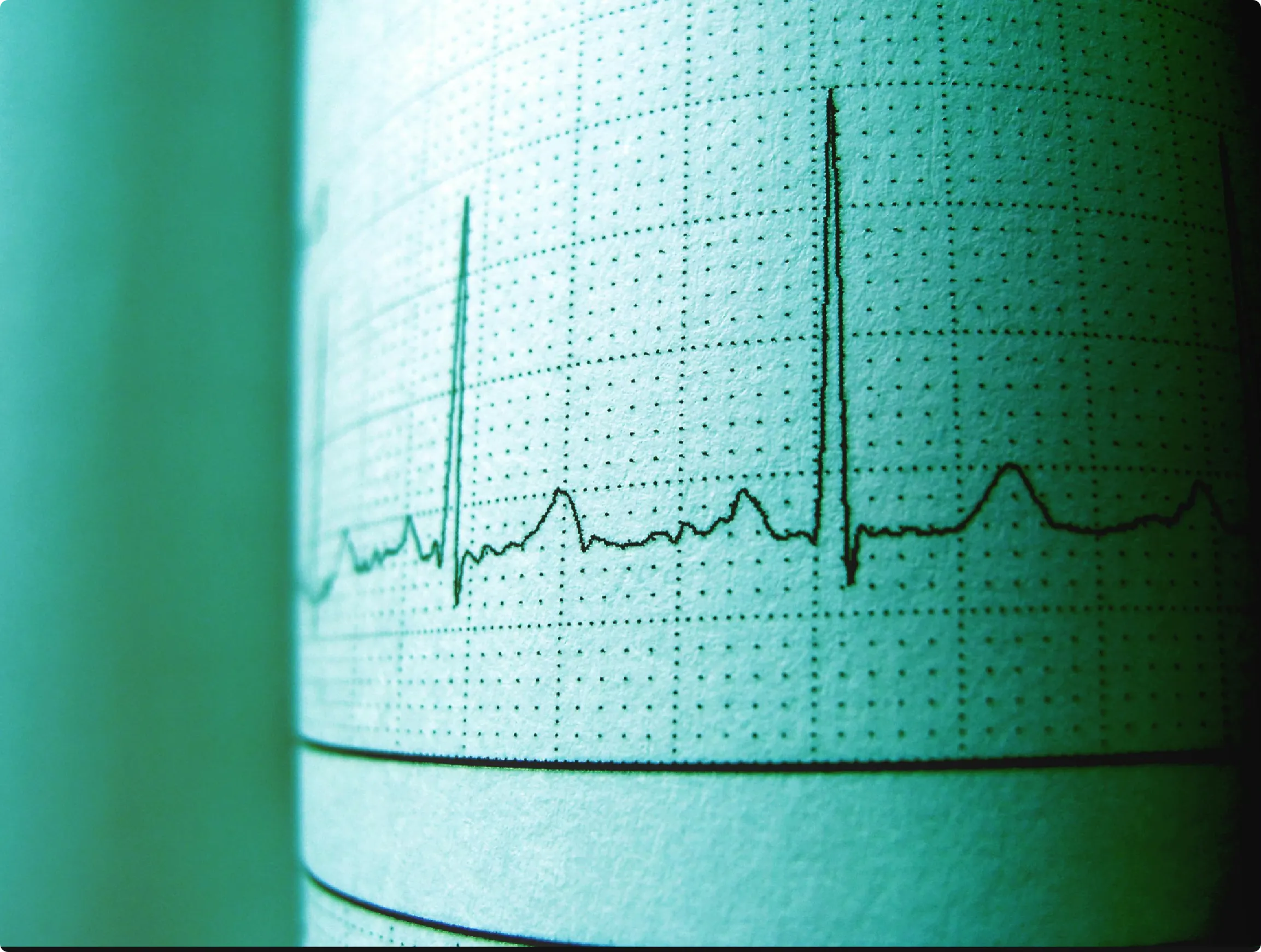 TCM Behandlung bei Herzrhythmusstörungen in Zürich