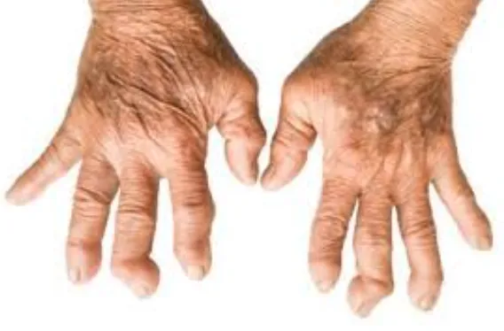 TCM Rheuma Therapie Zürich